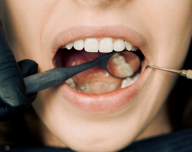 oralcancer